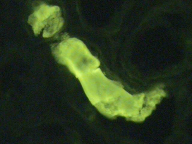 FIG.17  Inmunofluorescencia anti Lambda 200 X - <div style=